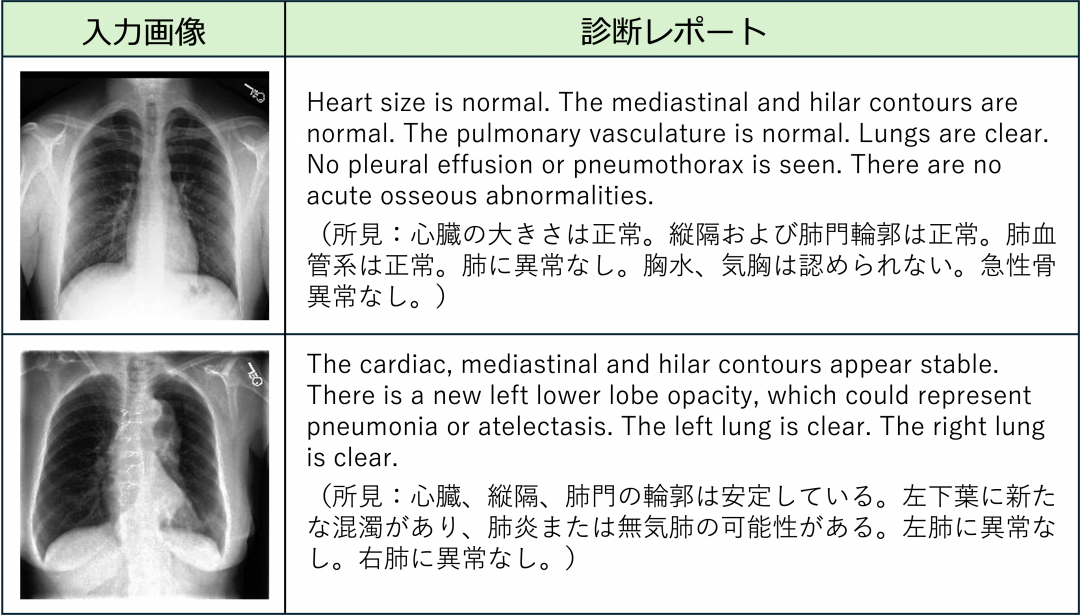 レントゲン画像から文章を生成