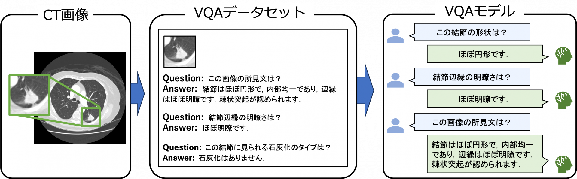 CT画像診断の対話型システム（Visual Question Answering: VQA）