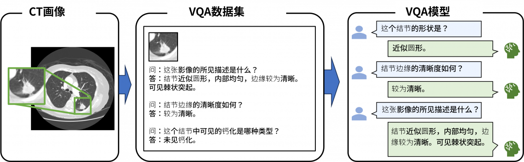 CT影像诊断的交互式系统(Visual Question Answering:VQA)