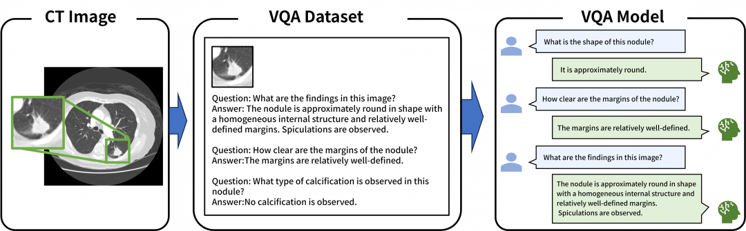 Interactive CT Image Diagnostic System (Visual Question Answering: VQA)